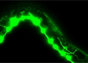 Malformed axonal growth cones in C. elegans worm