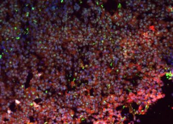 Immunofluorescence insulinoma