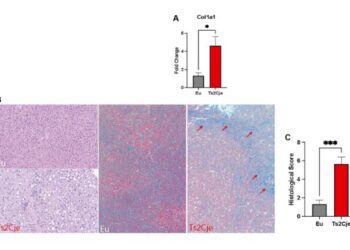 Aging exacerbates oxidative stress and liver fibrosis in an animal