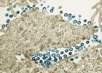 HIV-1 virus particles