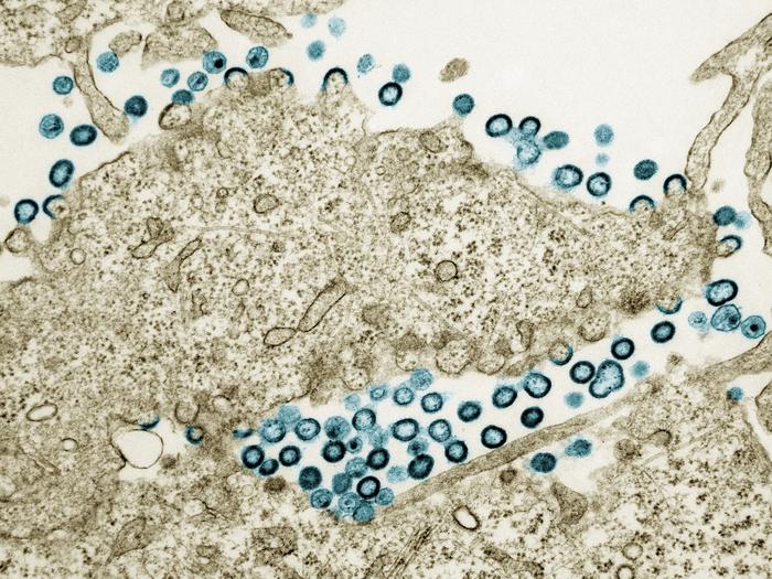 HIV-1 virus particles