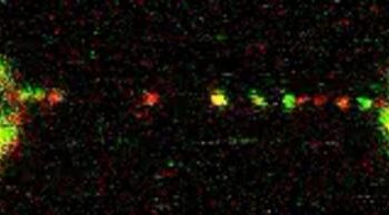 FANCI that! Decades long mystery of how DNA damage by