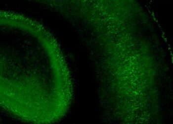Finding the sweet spot in brain development