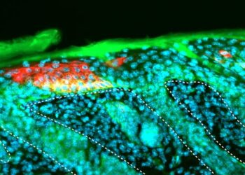 Key driver for epithelial cancer development identified