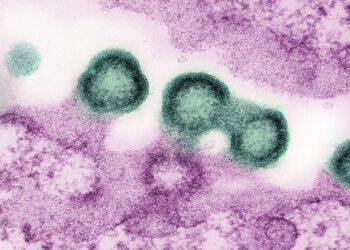 HIV-1 virus particles