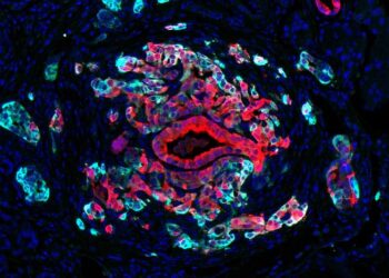 MSK discovery suggests opportunity to improve effectiveness of KRAS inhibitors
