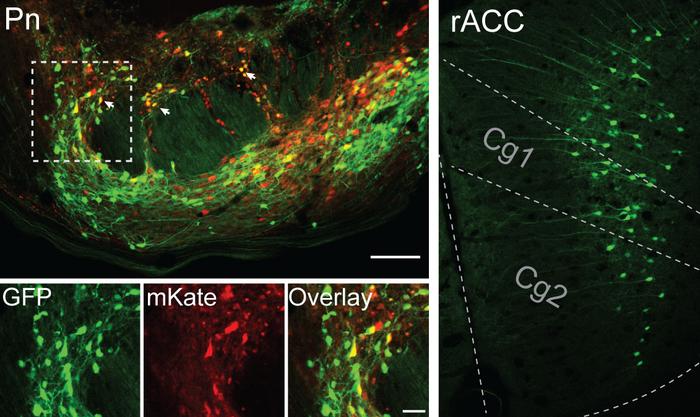 Neuroscience of Placebo Effect