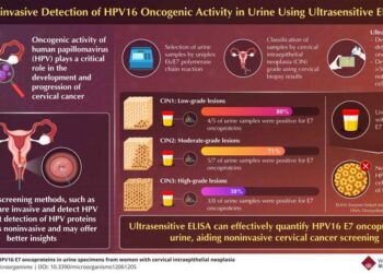 Detection of HPV16 E7 oncoproteins in urine samples using ultrasensitive enzyme-linked immunosorbent assay