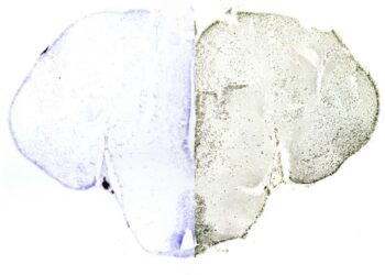 Brain staining of pregnant fish