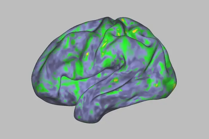 Psilocybin-1-main