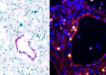 Infected mammary glands under microscope