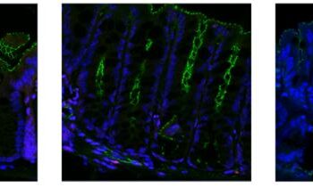 Immunofluorescent images of mouse colons