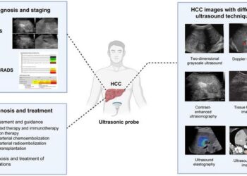 Ultrasonography of hepatocellular carcinoma: From diagnosis to prognosis