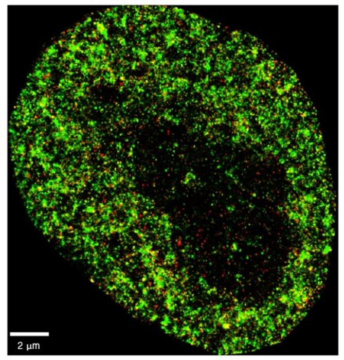 A super-resolution image of a HeLa cancer cell