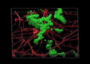 Amyloid beta plaque in neurons modeling late-onset Alzheimer's disease