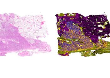 The image shows how the algorithm processes the typically coloured tissue section (left) and creates a map in which different types of tissue can be seen in different colours