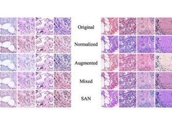 Tissue image datasets processed by stained SAN (bottom row) achieve color distributions that are more consistent than those processed using other techniques. Such consistency is essential when training machine-learning-based systems.