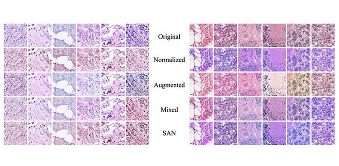 Tissue image datasets processed by stained SAN (bottom row) achieve color distributions that are more consistent than those processed using other techniques. Such consistency is essential when training machine-learning-based systems.