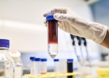 Blood sample in the laboratory