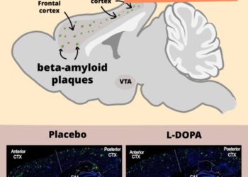 L-DOPA reduces harmful beta-amyloid plaques in AD model mice