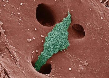 Macrophage mix helps determine rate and fate of fatty liver