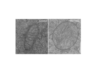 An unhealthy mitochondrion in a T cell exposed to METRNL