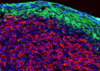 Old chemo drug, new pancreatic cancer therapy?