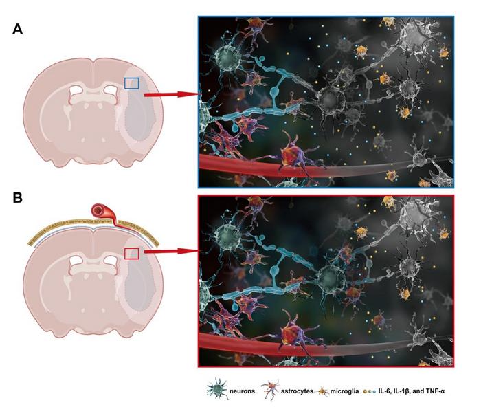 Schematic Representation of the Mechanism of Ischemic Stroke Treatment with m-EAI