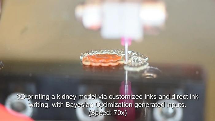 3d printing demo kidney