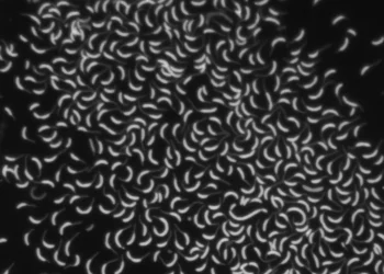 A fluorescent microscope image of Caulobacter crescentus cells stained to image their membranes