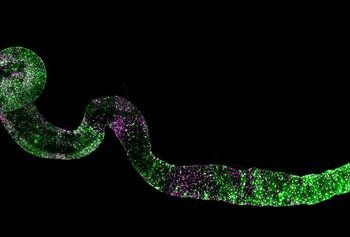 Fruit flies got guts.