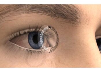 Lab-on-a-contact lens
