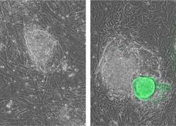 Before and after interferon gamma treatment