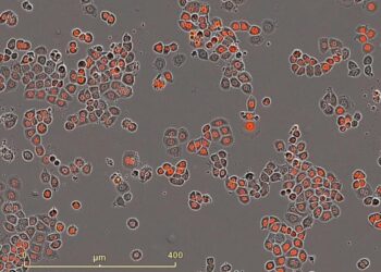 Breast cancer cell line MDAMB468