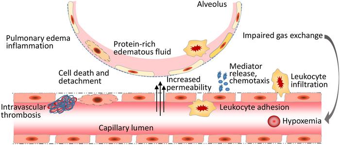 Endothelial barrier disruption leads to Acute Respiratory Distress Syndrome (ARDS)