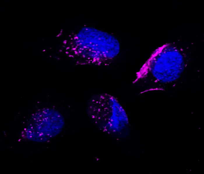 An image of head and neck cancer cells (in blue) treated with exosomes (in magenta)