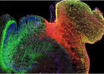 Fluorescent image of a developing human hippocampus.  

Credit: 
Oier Pastor-Alonso/UCSF