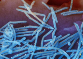 Human respiratory syncytial virus