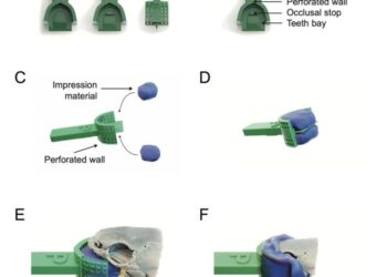 How the dental mold works