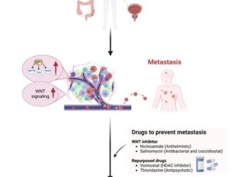 Breakthrough Discovery: Researchers Uncover Genes Linked to Cancer Metastasis