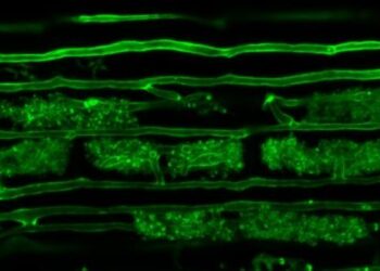 Plant-Microbe interactions
