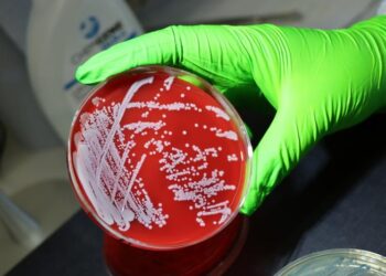 Staphylococcus aureus on petri dish