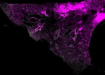 Lipid nanoparticles visualized using SCP-Nano technology at the cellular level in lung tissue.