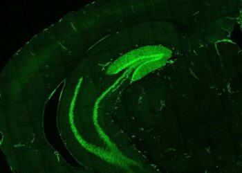IL-1R1 Helps Neurons to Directly Communicate with the Immune System