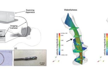 High-fidelity structural information and airflow data of a sleeping patient’s upper airway were obtained through OCT imaging and 3D reconstruction, allowing for precise identification of various anatomical sites with airflow obstruction.