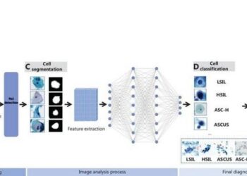 Schematic representation of AI-assisted cervical cytology image analysis.
