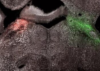 LPBN neurons labelled with fluorescence protein