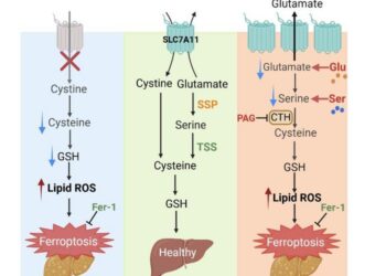 The mechanism underlying hepatic SLC7A11 promoting MASLD mediated by nonessential amino acids