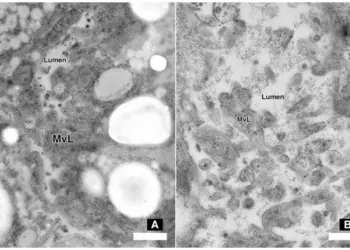Comparison of anterior midgut ultrastructure in soybean cyst nematode (SCN)