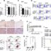 Breakthrough Combination Therapy Significantly Boosts Leukemia Cell Death